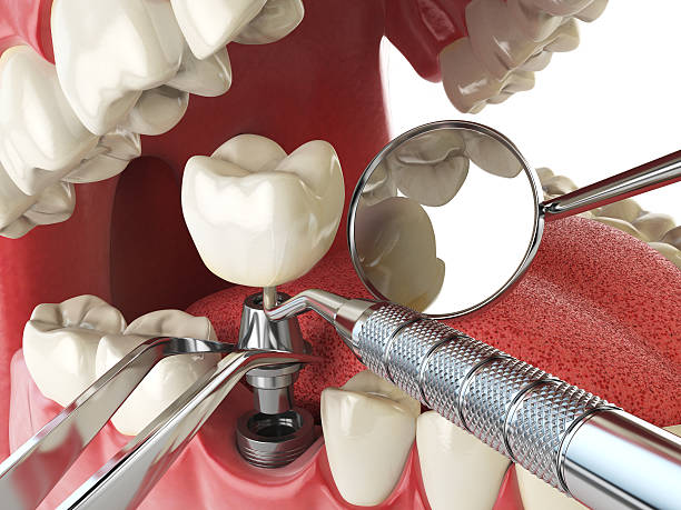 Best Tooth Infection Emergency Dentist  in Rossmoor, NJ